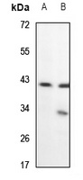 Alpha-actin Rabbit Polyclonal Antibody