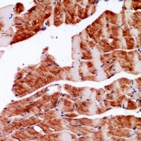 Alpha-actin Rabbit Polyclonal Antibody