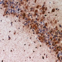 K Cadherin Rabbit Polyclonal Antibody