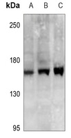 SCP2 Rabbit Polyclonal Antibody