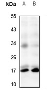 TRP14 Rabbit Polyclonal Antibody