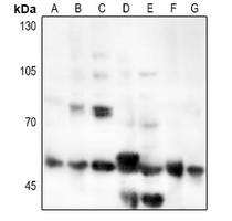 CD126 Rabbit Polyclonal Antibody