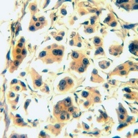 CD126 Rabbit Polyclonal Antibody