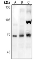 NOX1 Rabbit Polyclonal Antibody