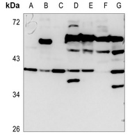 CD129 Rabbit Polyclonal Antibody