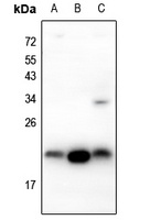 IGF1 Rabbit Polyclonal Antibody