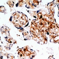 IGF1 Rabbit Polyclonal Antibody