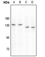 MERTK/TYRO3 (Phospho-Y749/681) Rabbit Polyclonal Antibody