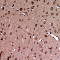 MERTK/TYRO3 (Phospho-Y749/681) Rabbit Polyclonal Antibody