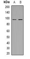 MERTK/TYRO3 (Phospho-Y753/685) Rabbit Polyclonal Antibody