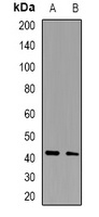 MKK1 Rabbit Polyclonal Antibody