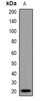 BCL2 Rabbit Polyclonal Antibody