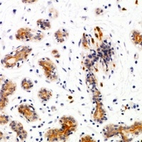SEC22B Rabbit Polyclonal Antibody