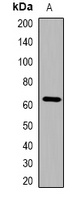 Cytokeratin-pan Rabbit Polyclonal Antibody