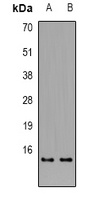 Alpha-tubulin Rabbit Polyclonal Antibody
