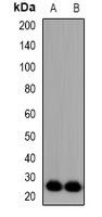 FGF11 Rabbit Polyclonal Antibody