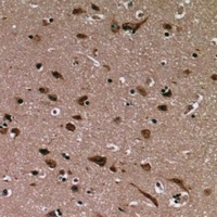 Annexin A1 Rabbit Polyclonal Antibody