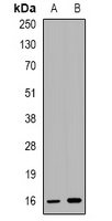 CCL4 Rabbit Polyclonal Antibody