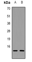 Galectin 1 Rabbit Polyclonal Antibody