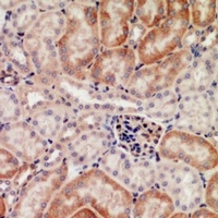 Galectin 1 Rabbit Polyclonal Antibody