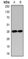 KIM1 Rabbit Polyclonal Antibody