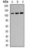 CD21 Rabbit Polyclonal Antibody