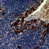 CD21 Rabbit Polyclonal Antibody