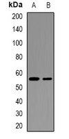 WISP3 Rabbit Polyclonal Antibody