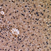 WISP3 Rabbit Polyclonal Antibody