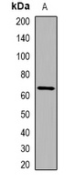 IL-31 Rabbit Polyclonal Antibody