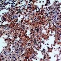 IL-31 Rabbit Polyclonal Antibody
