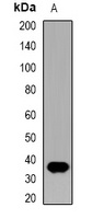 IL-12B Rabbit Polyclonal Antibody