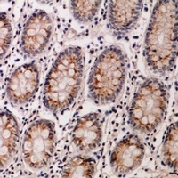 IL-12B Rabbit Polyclonal Antibody