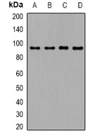 TGFBR3 Rabbit Polyclonal Antibody
