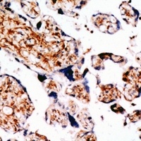 TGFBR3 Rabbit Polyclonal Antibody