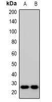IMP3 Rabbit Polyclonal Antibody