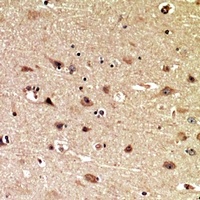 MIB1 Rabbit Polyclonal Antibody