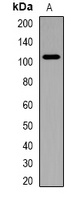 Catenin delta 1 Rabbit Polyclonal Antibody