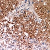 Catenin delta 1 Rabbit Polyclonal Antibody