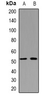 Cytokeratin 14/17 Rabbit Polyclonal Antibody