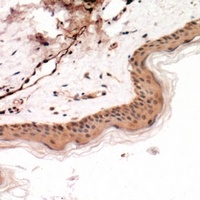 Cytokeratin 14/17 Rabbit Polyclonal Antibody