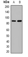 Beta Amyloid Rabbit Polyclonal Antibody