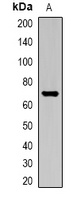 ALB Rabbit Polyclonal Antibody