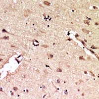 ALB Rabbit Polyclonal Antibody
