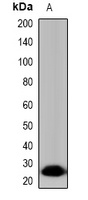 Tryptase delta Rabbit Polyclonal Antibody