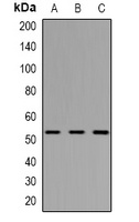 Vimentin Rabbit Polyclonal Antibody