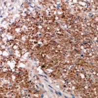 Vimentin Rabbit Polyclonal Antibody