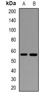 IL-17RB Rabbit Polyclonal Antibody