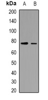 TRIF Rabbit Polyclonal Antibody