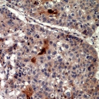 TRIF Rabbit Polyclonal Antibody